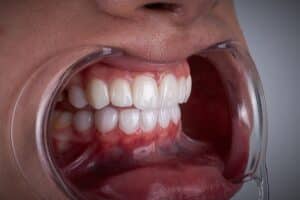 Cosmetic Dentistry Pasadena
