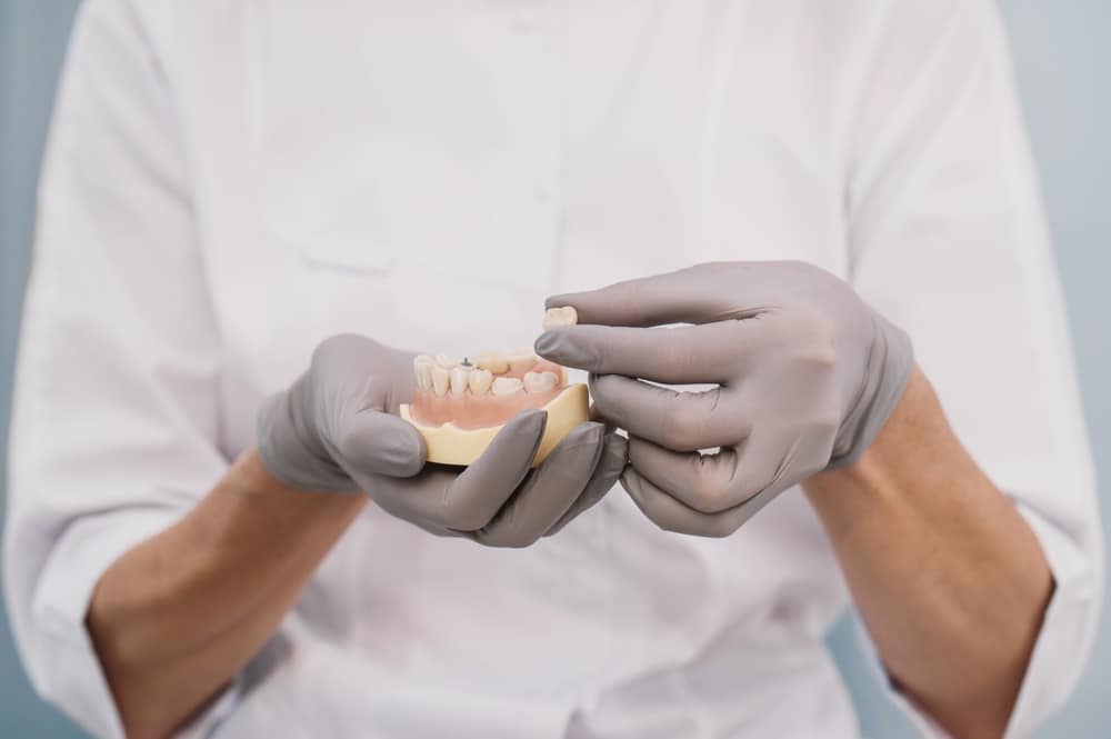 Dental Crowns Pasadena