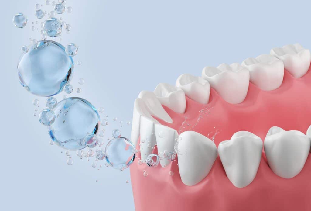 Fluoride treatment Pasadena